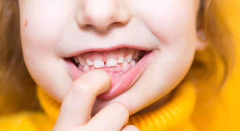 PERIODONCIA